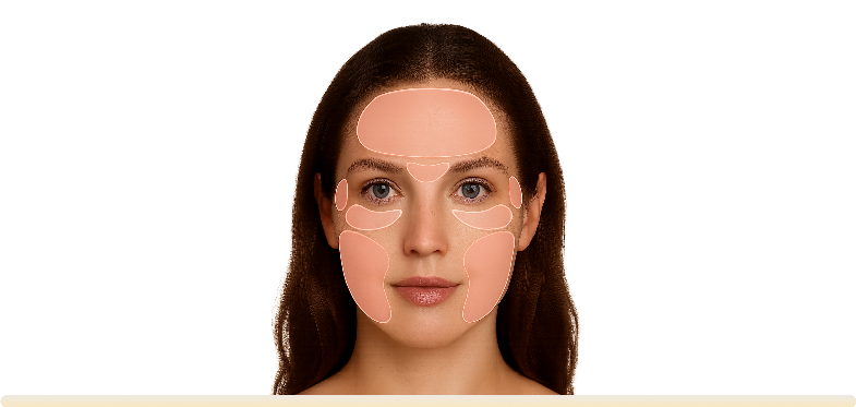 continuous innovation